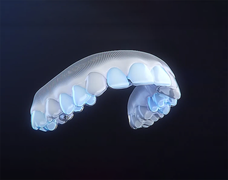 Model 3D Invisalign | Orthodontie des Laurentides à St Jérôme